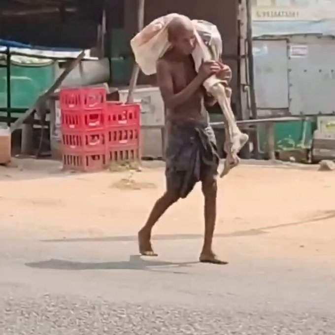 कहीं कंधे पर कंकाल तो कहीं हाथ में ड्रिप मरते जमीर की कहानी………
