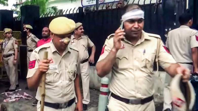 CJP प्रदर्शन में घायल पुलिसकर्मियों के परिजनों का दर्द…………..